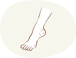 手足のひび