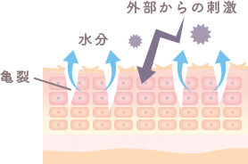 皮ふの表面が荒れたイメージ