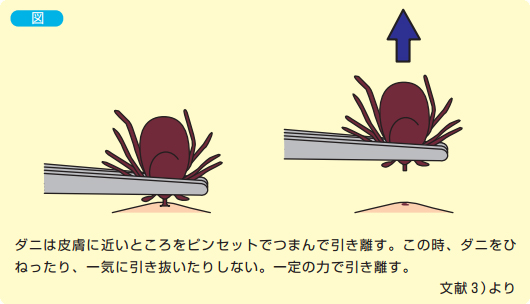 マダニ 取っ て しまっ た