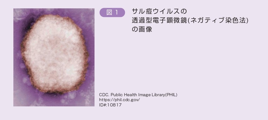 図1.サル痘ウイルスの 透過型電子顕微鏡(ネガティブ染色法) の画像