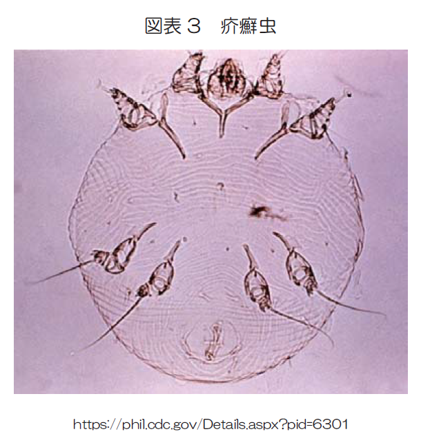 図表3　疥癬虫