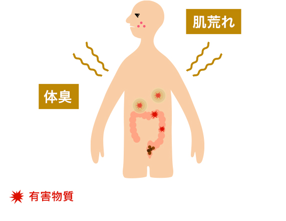 便秘が引き起こす、肌荒れや体臭の画像