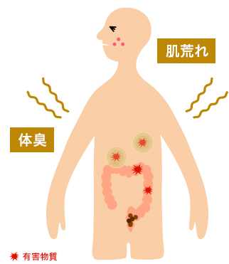 便秘が引き起こす、肌荒れや体臭の画像