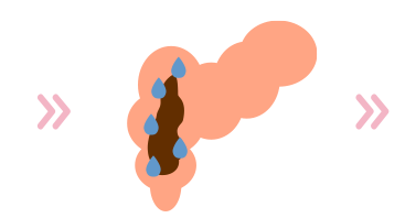 集まった水分により便が柔らかくなる画像