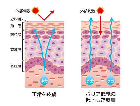 医師監修 肌の黒ずみは乾燥肌が原因 色素沈着のメカニズムや予防策について解説