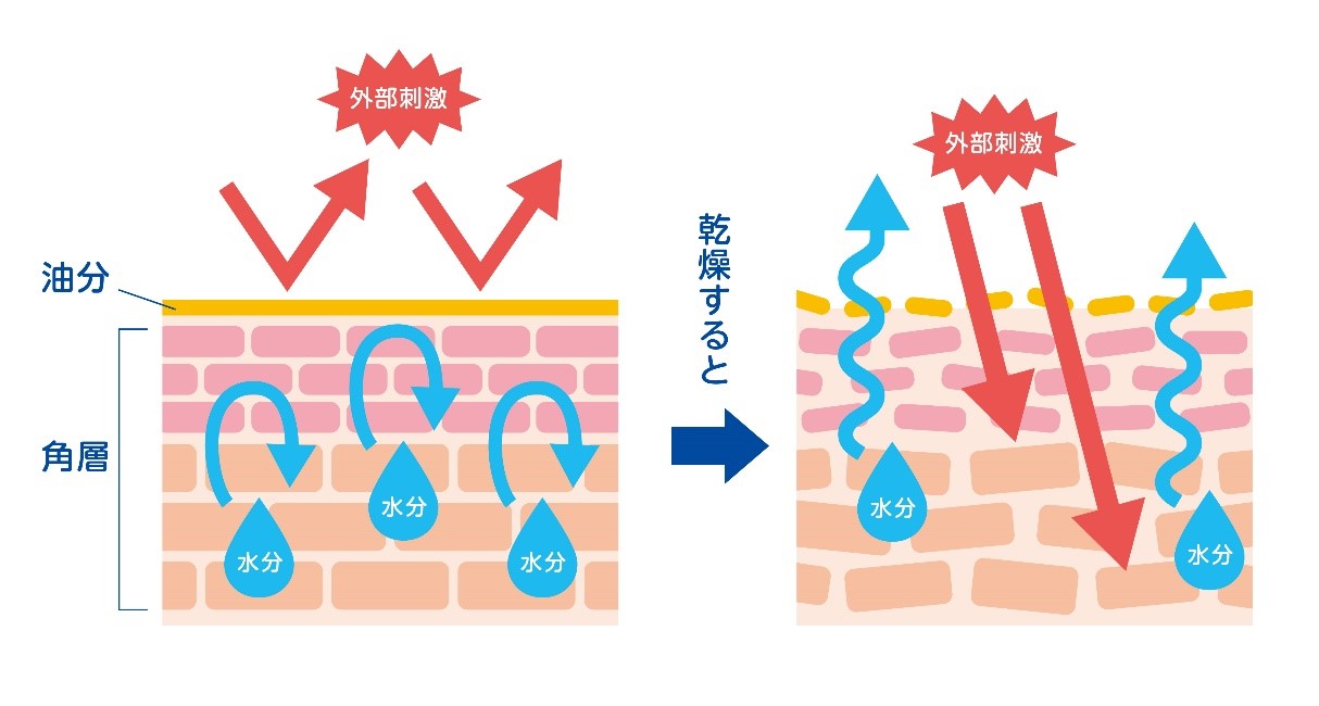 医師監修 ガサガサうろこ肌の原因と対策とは 乾燥肌の人が気を付けるべきポイント