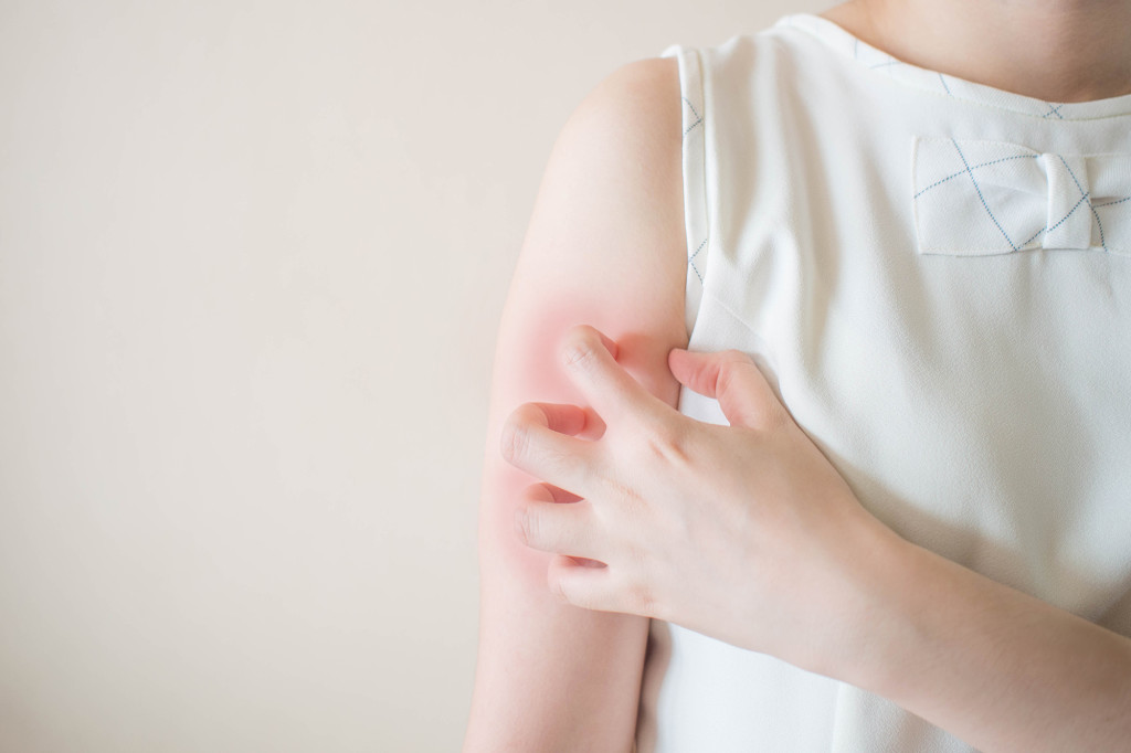 医師監修 かゆみを伴う乾燥肌でも掻くのはng 傷をつくらないための対処法 健栄生活 医師監修 かゆみを伴う乾燥肌でも掻くのはng 傷をつくらないための対処法 健栄生活