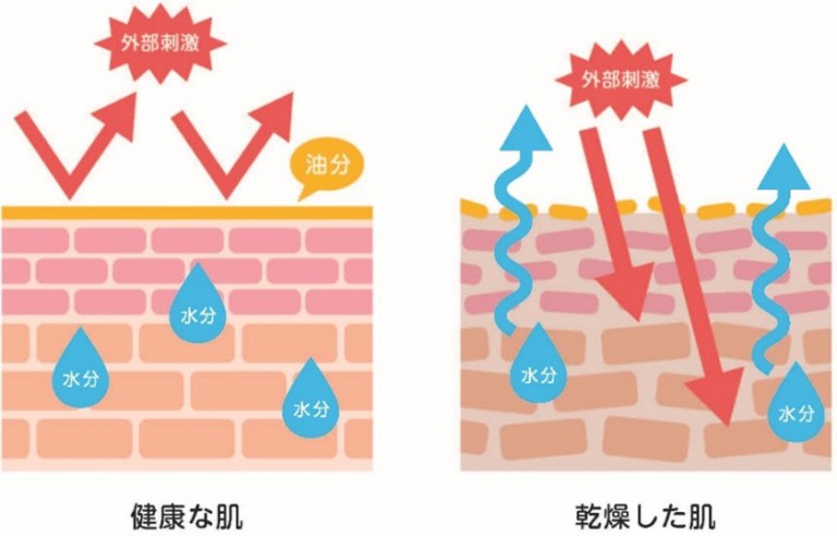 【医師監修】乾燥肌はどう予防する？原因と防ぐ方法を徹底解説