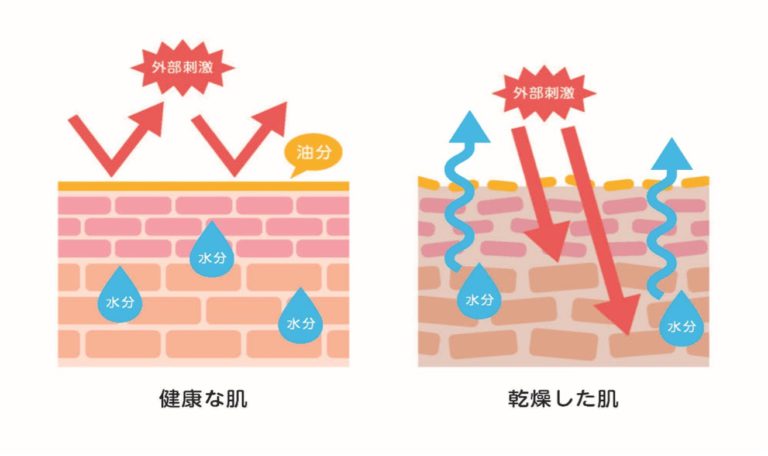 【医師監修】乾燥肌にはどんなサプリがいい？おすすめの成分とその効果を解説