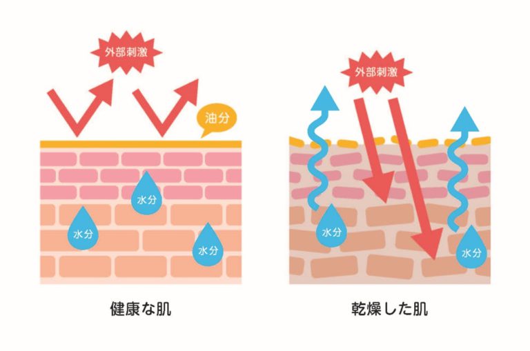 【医師監修】ひどい乾燥肌の原因は？意識したいスキンケアのポイントも紹介