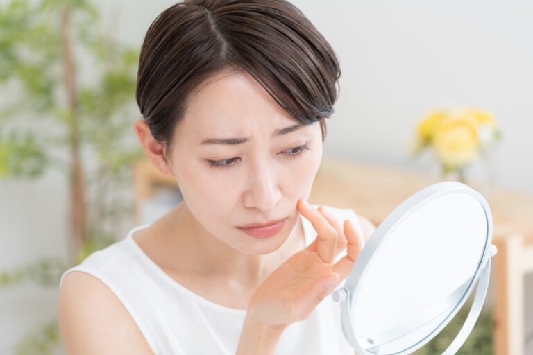 【医師監修】頬の肌荒れを繰り返す原因は？種類と対策方法を徹底解説