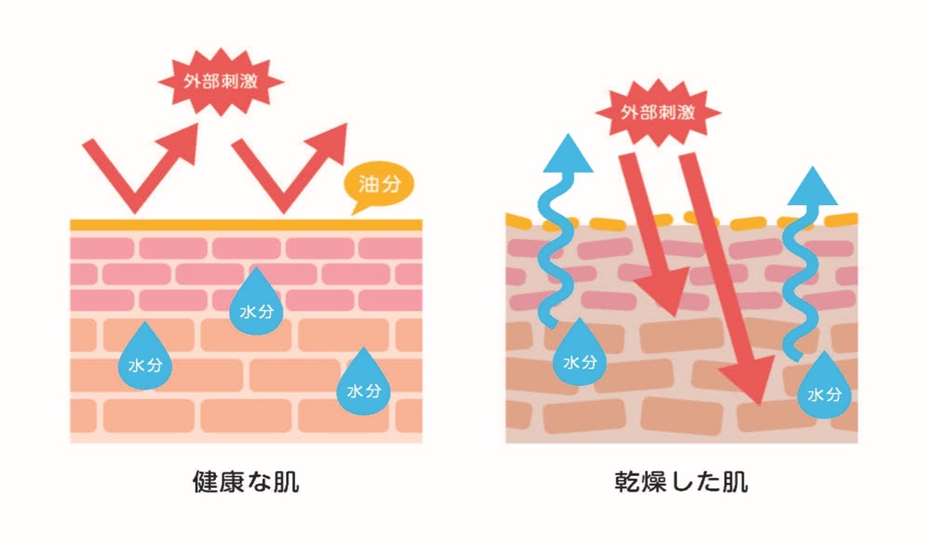 乾燥肌にはどんなサプリがいい？おすすめの成分とその効果を解説